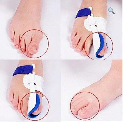 Bunion Brace - Corrector Splint ~ Pain Relief!