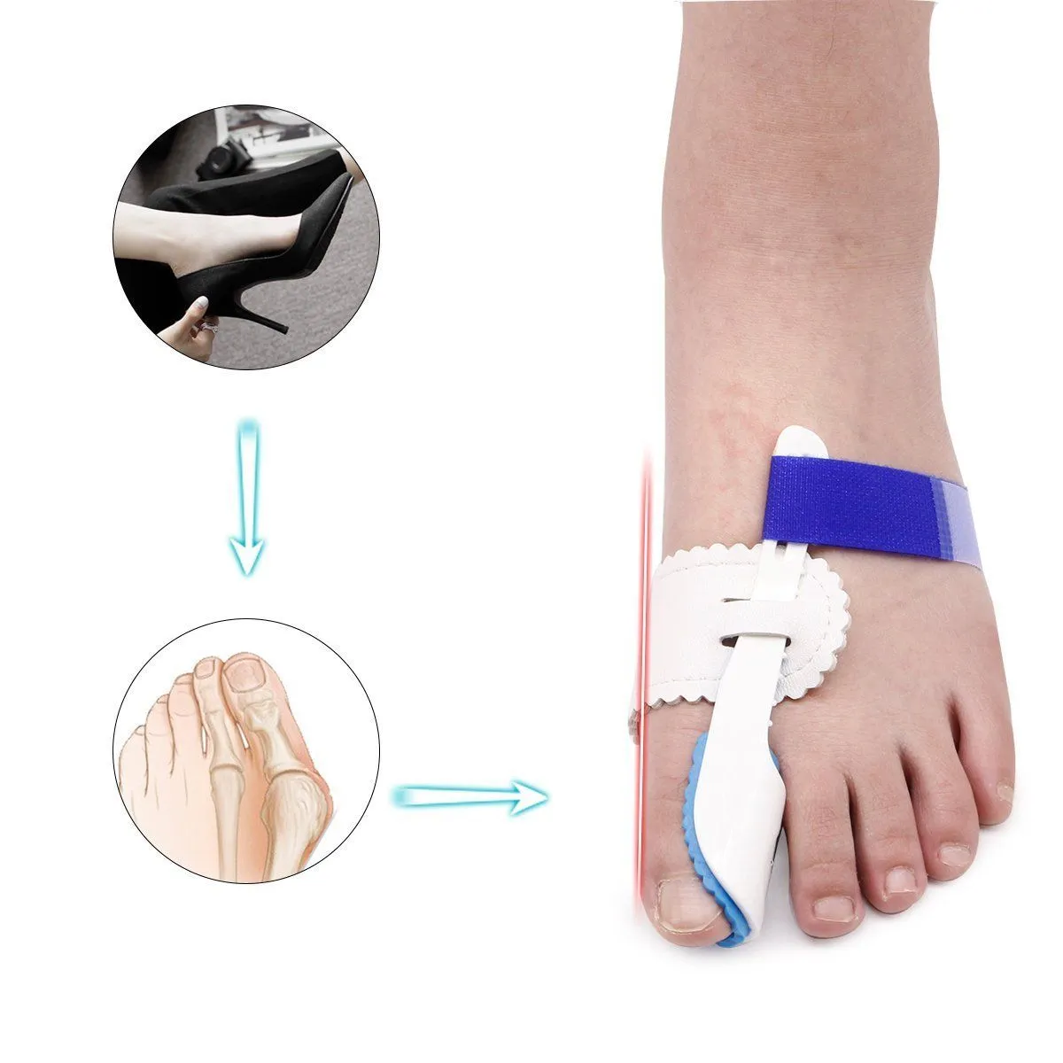 Bunion Brace - Corrector Splint ~ Pain Relief!